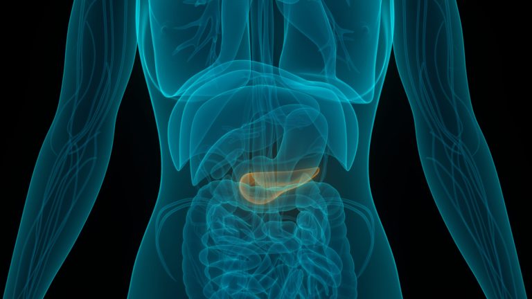 Study ties alcohol to pancreatic cancer