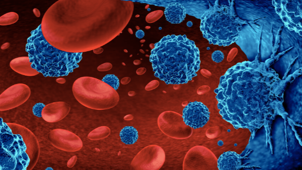 A subtle cry for help: Anaemia in cancer