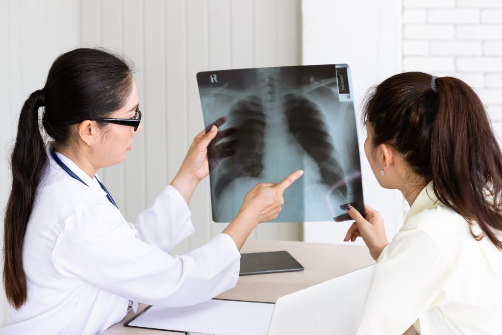 Bridging the Gap in Malaysia’s Lung Cancer Care - Cancer Matters