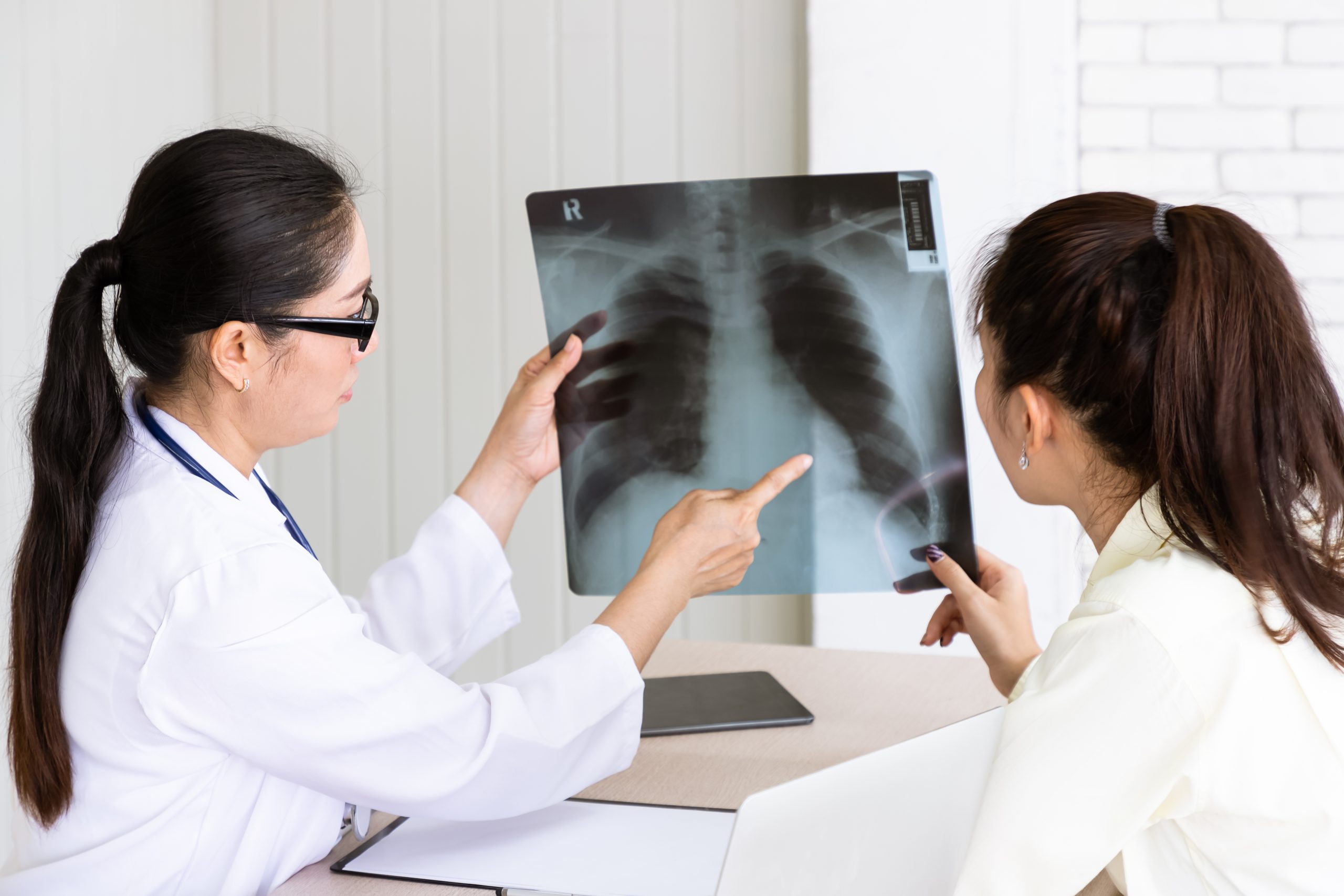 Bridging the Gap in Malaysia’s Lung Cancer Care 