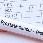 Prostate Cancer Screening: Why Malaysia Needs Local Evidence and Local Action 