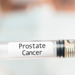 Prostate Cancer Part 8 – Management of Locally Advanced Prostate Cancer In 2026 