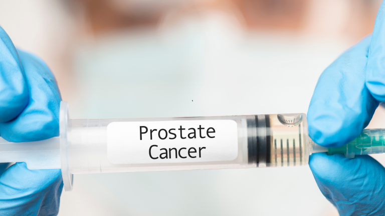 Prostate Cancer Part 8 – Management of Locally Advanced Prostate Cancer In 2026 