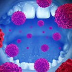 Mouth Self Examination: More Than Just Cancer Detection 