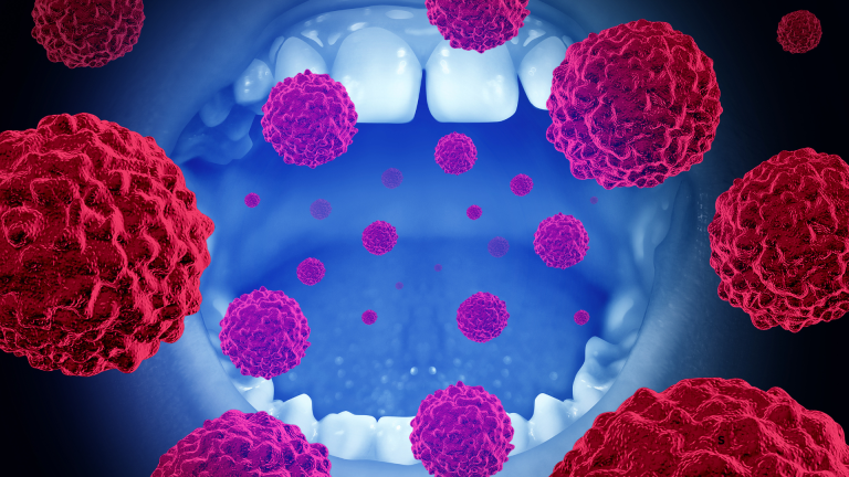 Mouth Self Examination: More Than Just Cancer Detection 