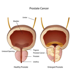 Prostate Cancer Part 14 (Finale) – Current Advances In Techniques And Technologies In Prostate Cancer Management In 2026